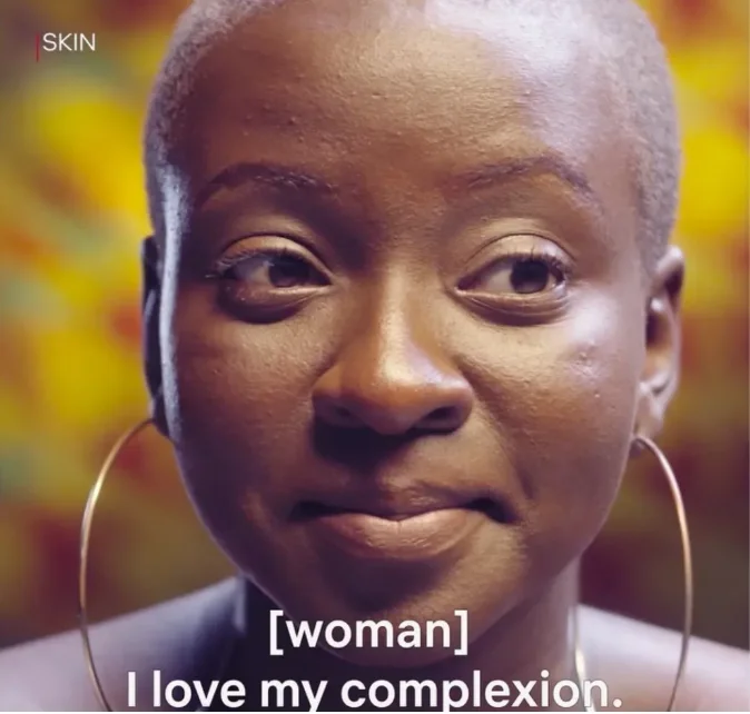 African Actress Shines Light on Colorism in Netflix Documentary